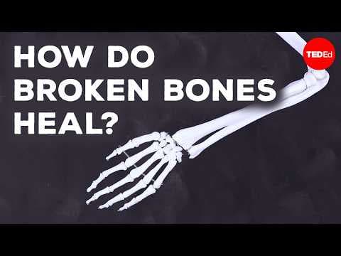 What Happens When You Break a Bone?